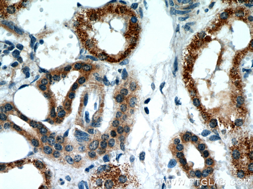 IHC staining of human kidney using 12766-1-AP