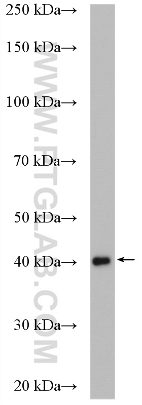 WB analysis of mouse retina using 14569-1-AP