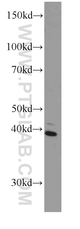 WB analysis of human brain using 66136-1-Ig (same clone as 66136-1-PBS)