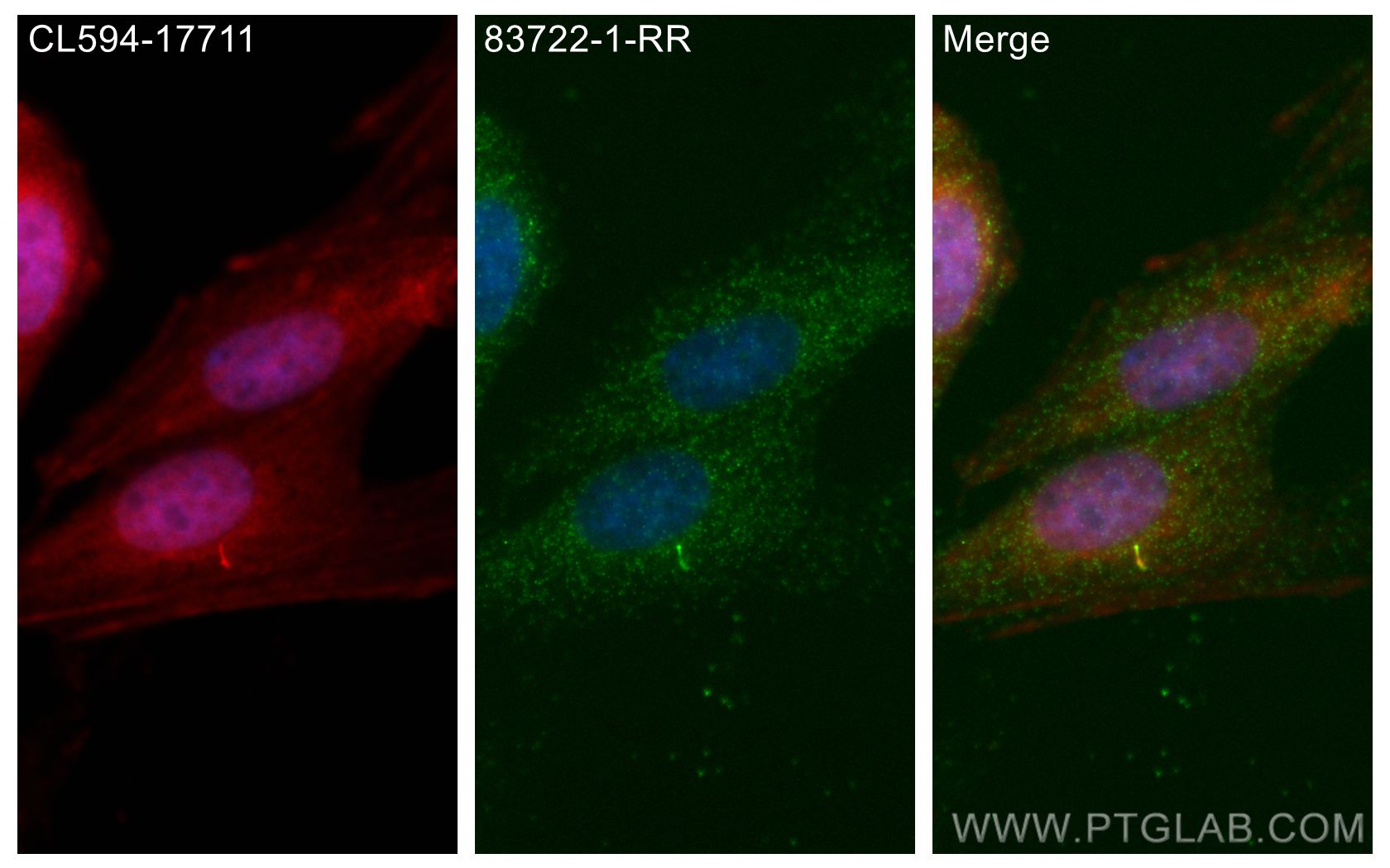 IF Staining of MDCK using 83722-1-RR (same clone as 83722-1-PBS)