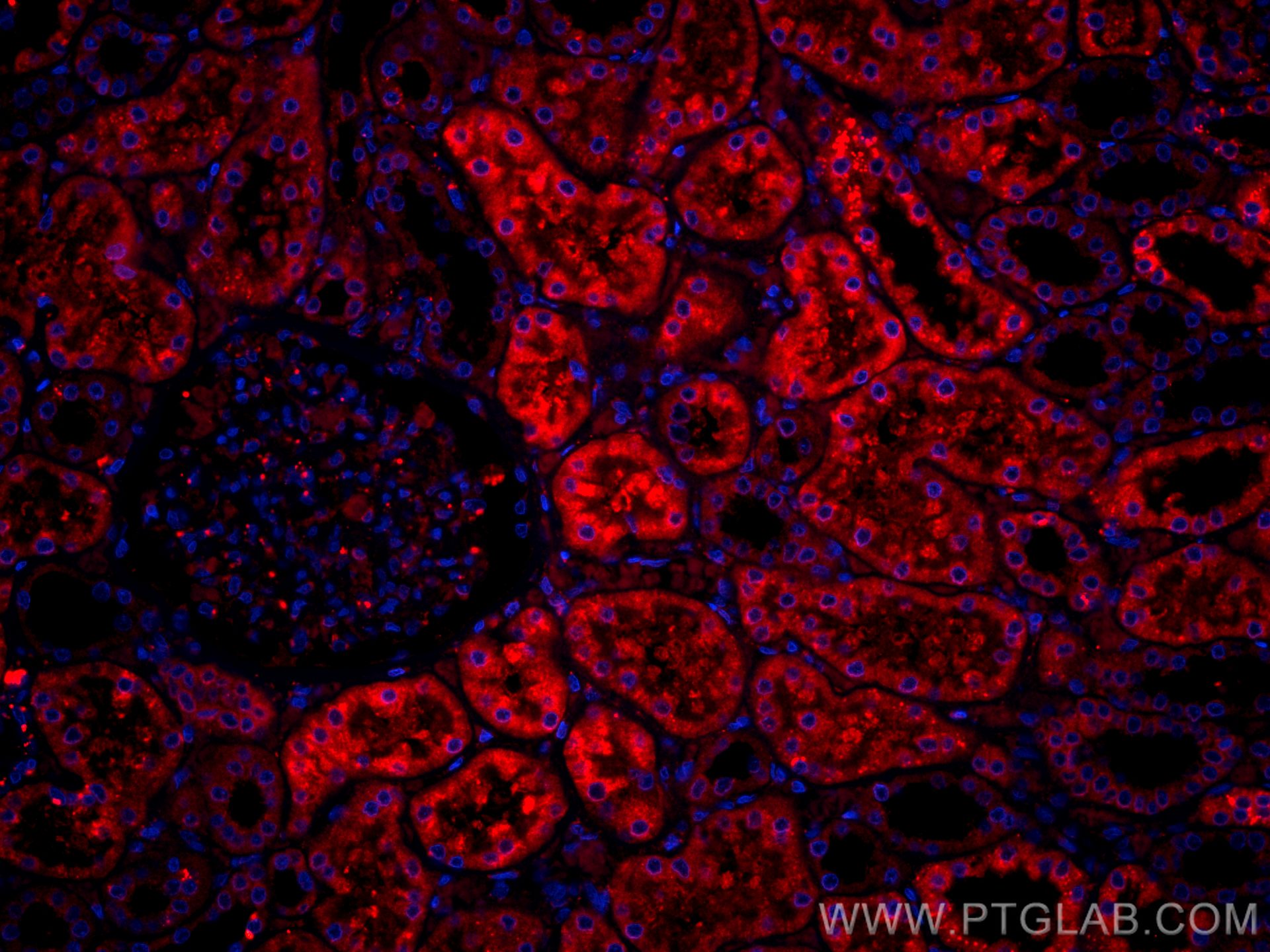 IF Staining of human kidney using CL594-66136