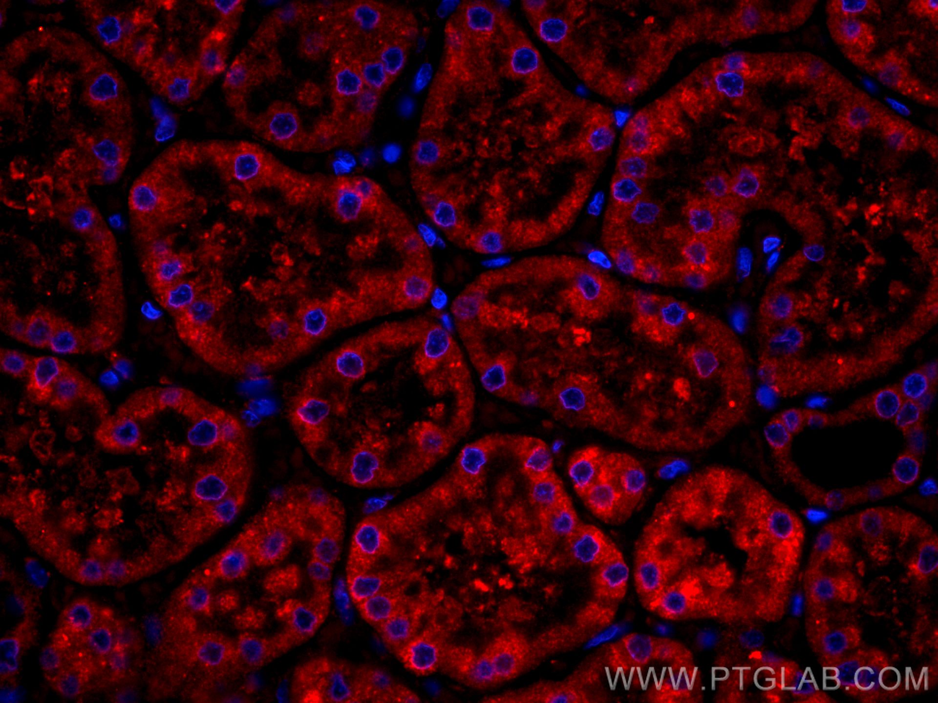IF Staining of human kidney using CL594-66136