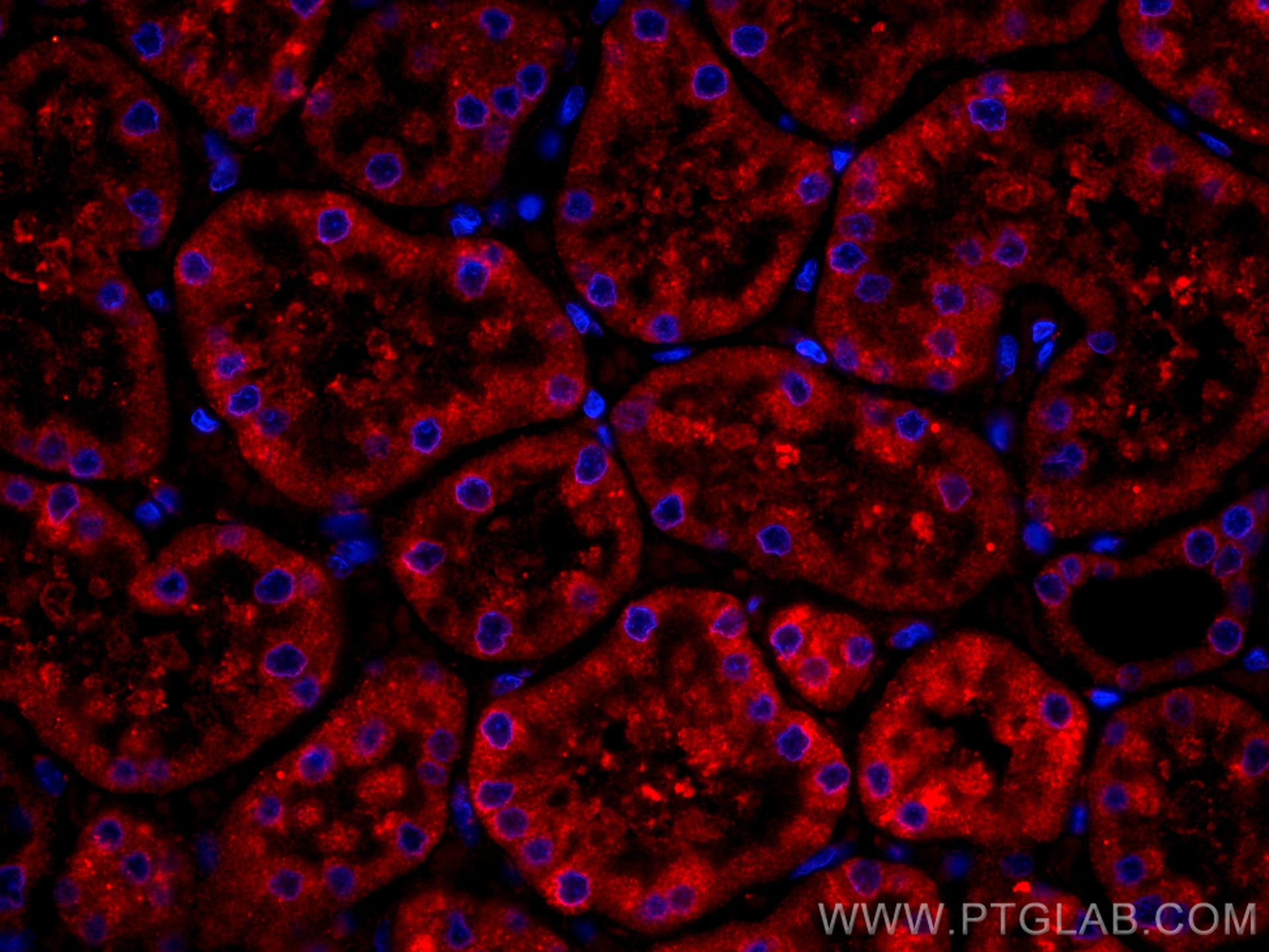 IF Staining of human kidney using CL594-66136