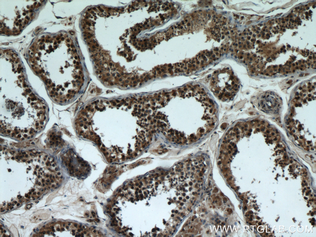 IHC staining of human testis using 18961-1-AP