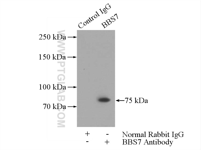 IP experiment of mouse testis using 18961-1-AP