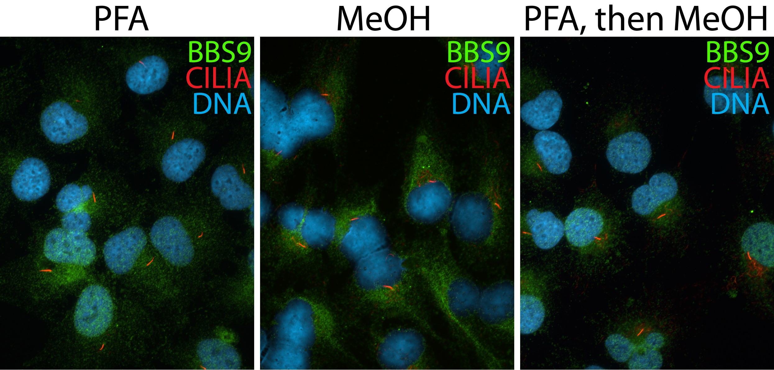 IF Staining of hTERT-RPE1 cells using 14460-1-AP