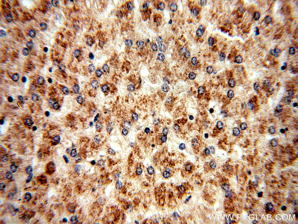 IHC staining of human liver using 14460-1-AP