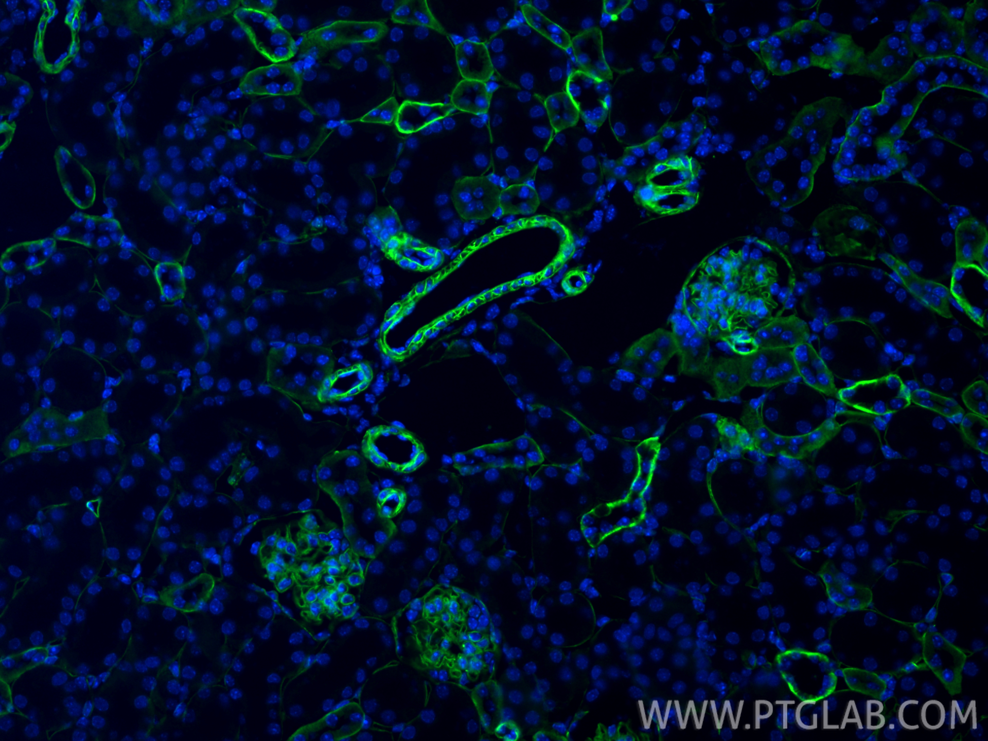 IF Staining of mouse kidney using 33665-1-AP