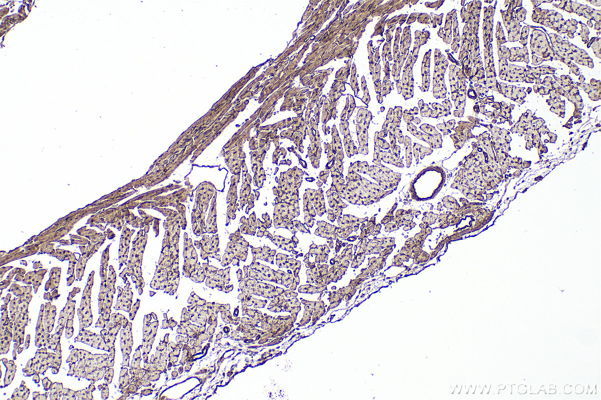 IHC staining of mouse heart using 33665-1-AP