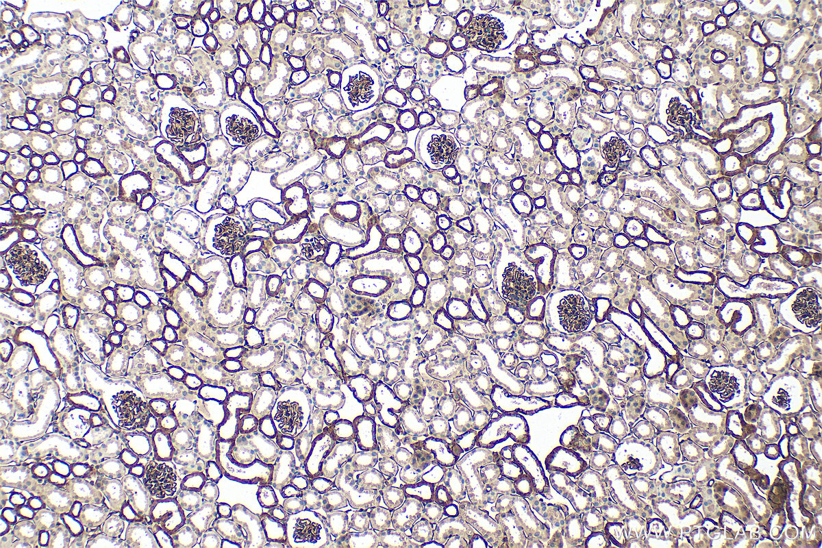 IHC staining of mouse kidney using 33665-1-AP