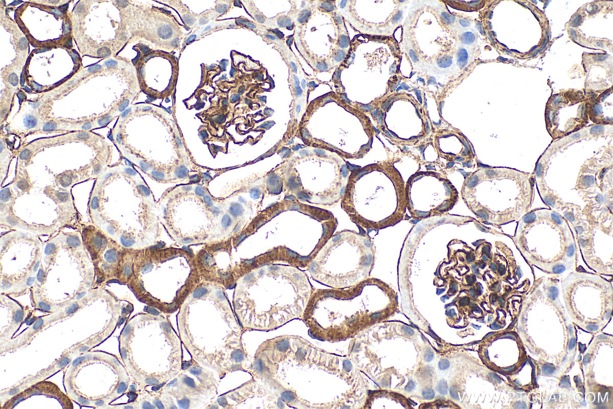 IHC staining of mouse kidney using 33665-1-AP