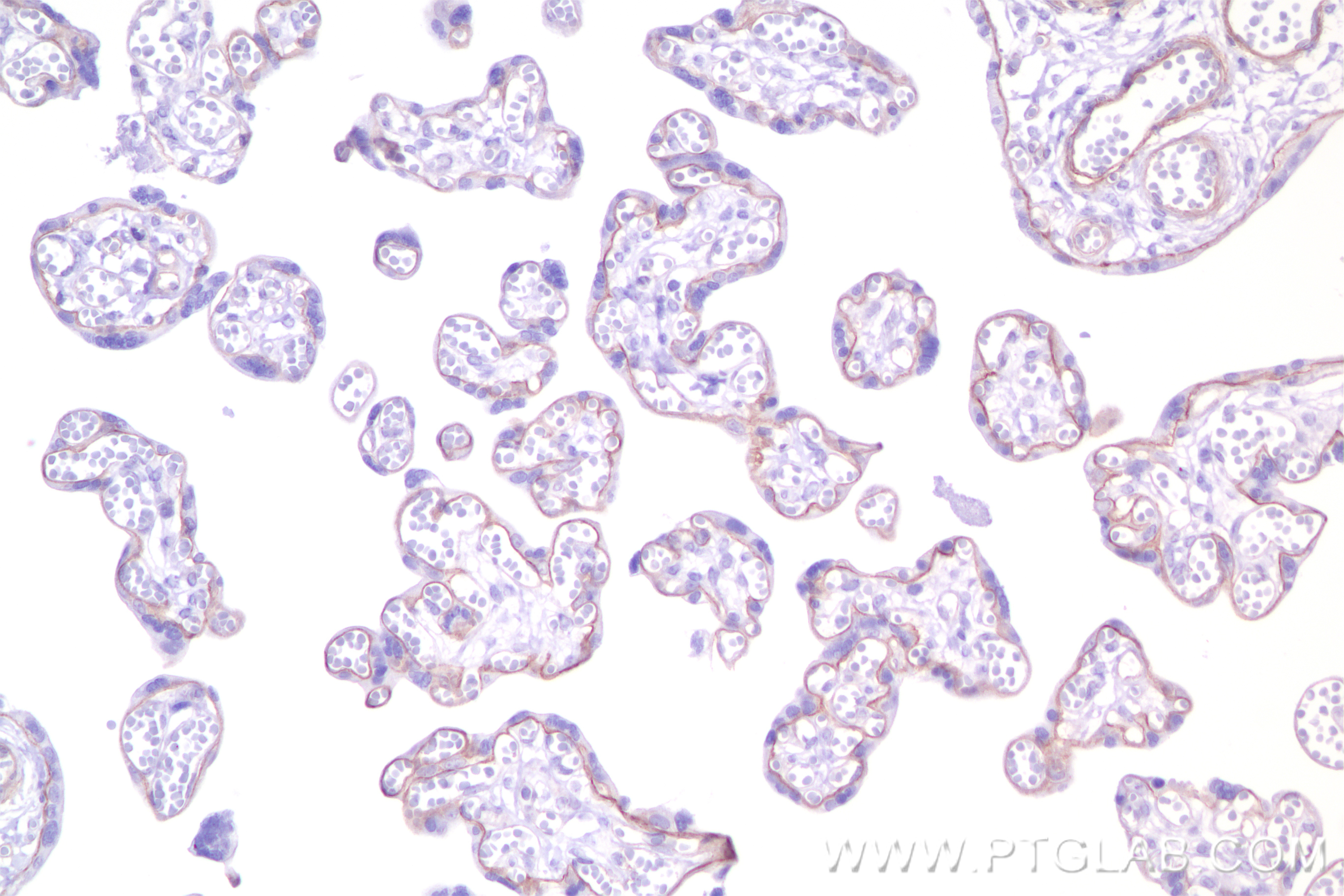 IHC staining of human placenta using 84038-3-RR