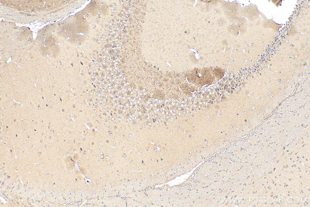 IHC staining of mouse brain using 19017-1-AP