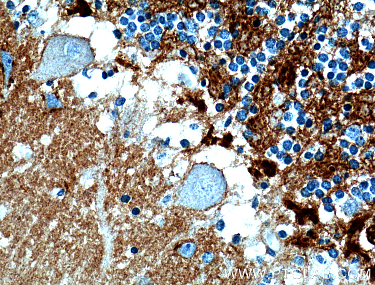 IHC staining of human cerebellum using 19017-1-AP