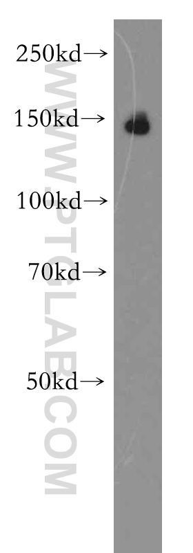 Brevican Polyclonal antibody