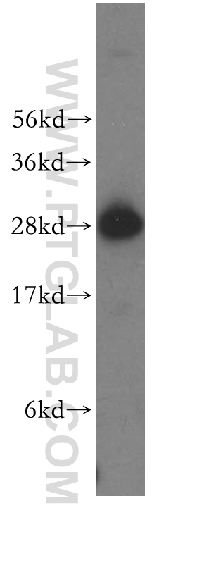 BAP29 Polyclonal antibody