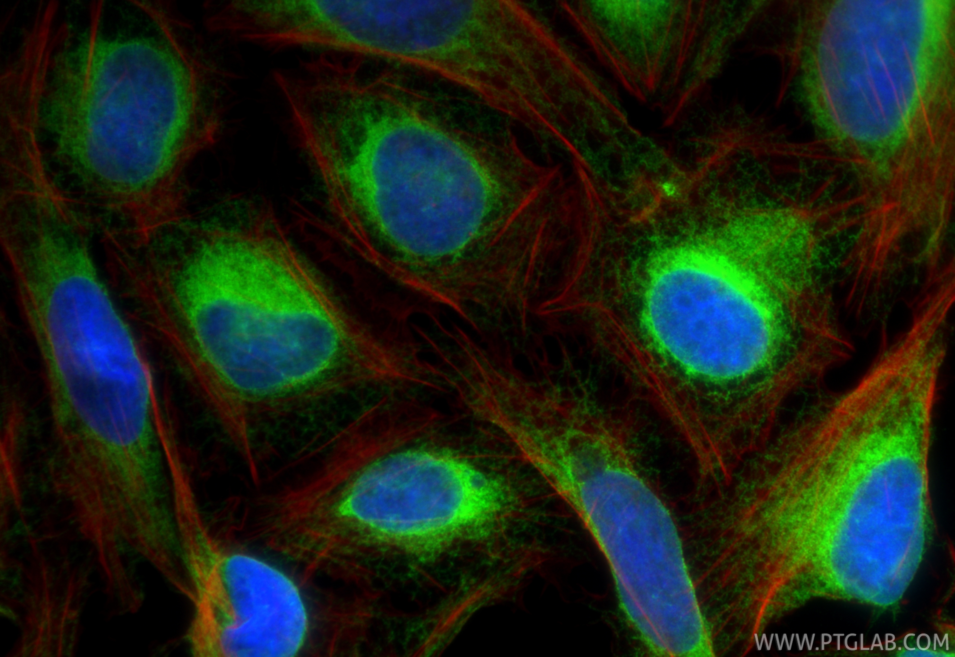 IF Staining of U2OS using 11200-1-AP IF Staining of U2OS using 11200-1-AP