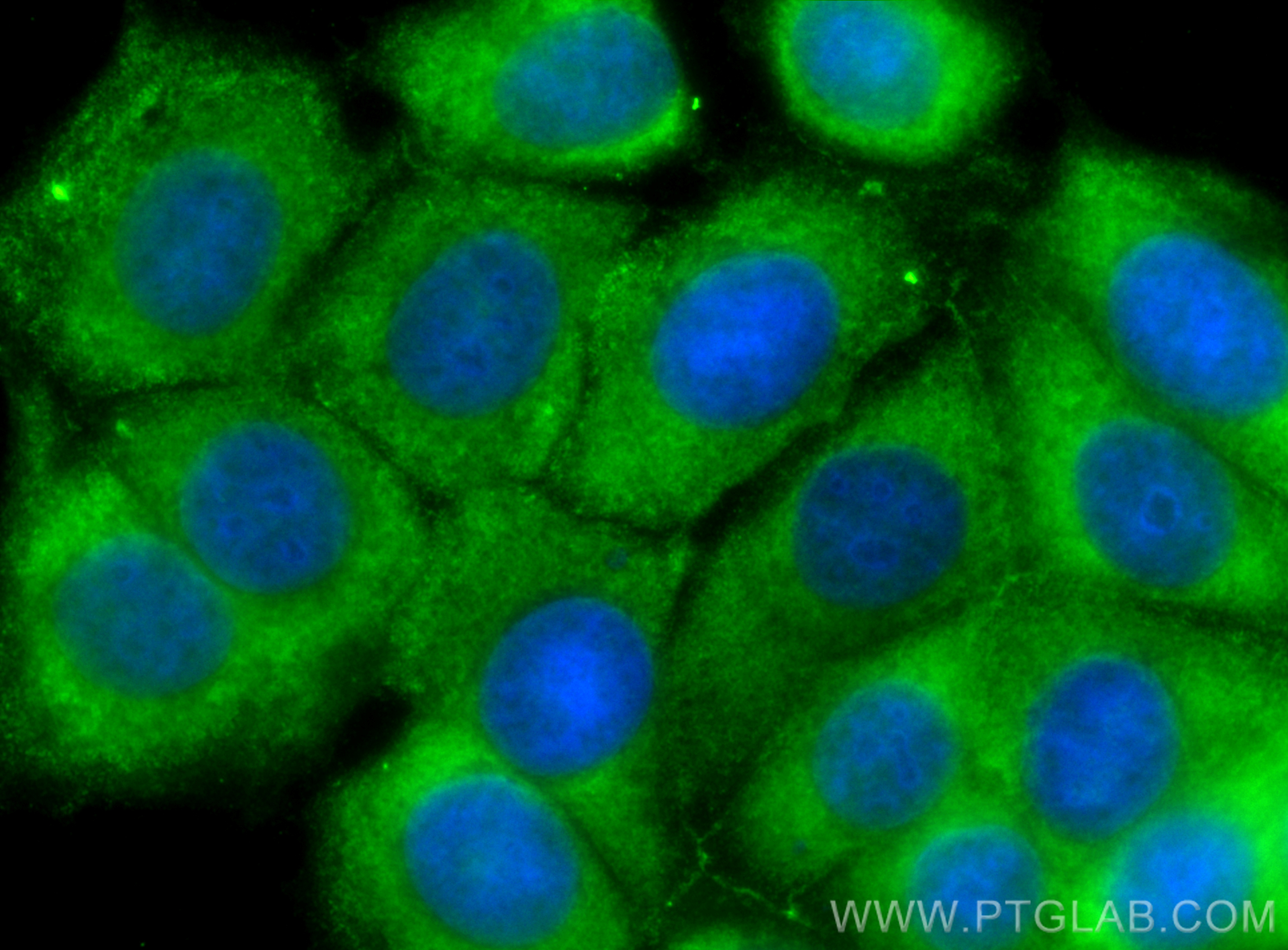 IF Staining of MCF-7 using CL488-67215