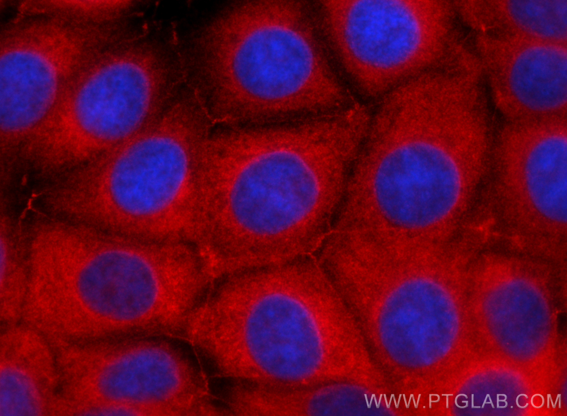 IF Staining of MCF-7 using CL594-67215