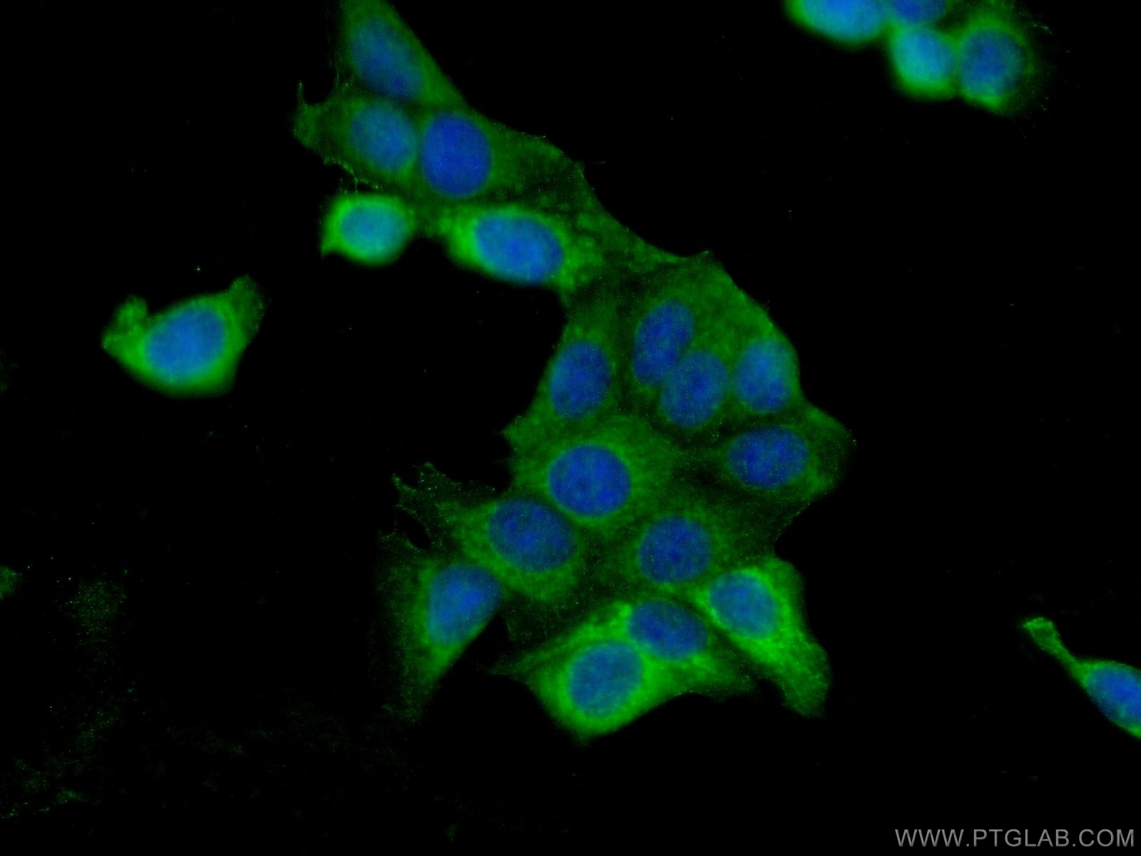 IF Staining of MCF-7 using 25776-1-AP