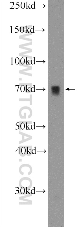 WB analysis of NIH/3T3 using 25776-1-AP