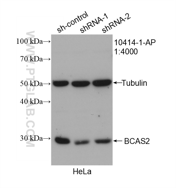 WB analysis of HeLa using 10414-1-AP