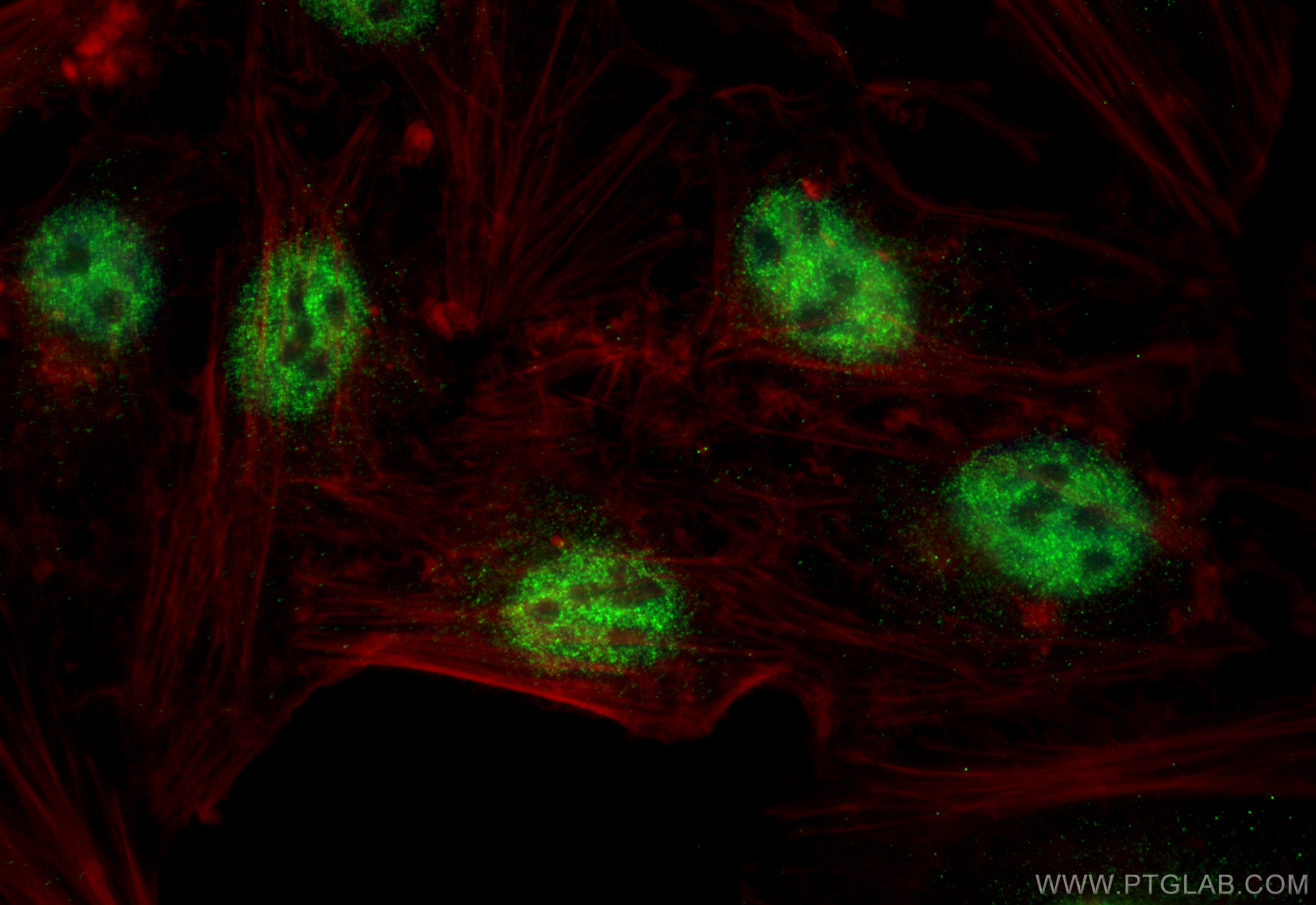 IF Staining of HeLa using 68003-1-Ig