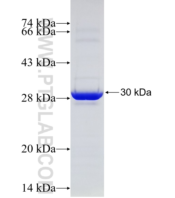 BCAS2 fusion protein Ag21309 SDS-PAGE