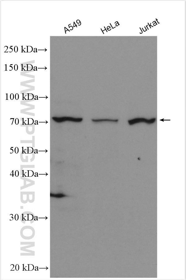 WB analysis using 10402-1-AP