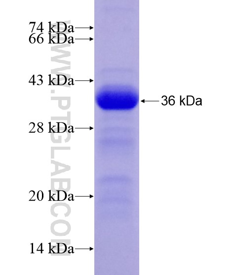 BCAS3 fusion protein Ag28545 SDS-PAGE