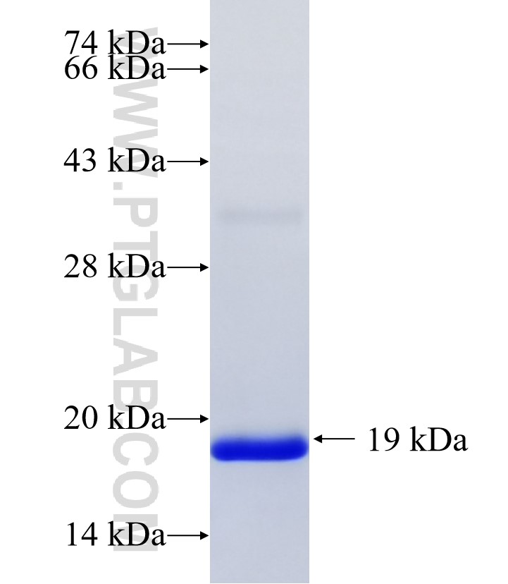 BCAS4 fusion protein Ag36244 SDS-PAGE BCAS4 fusion protein Ag36244 SDS-PAGE