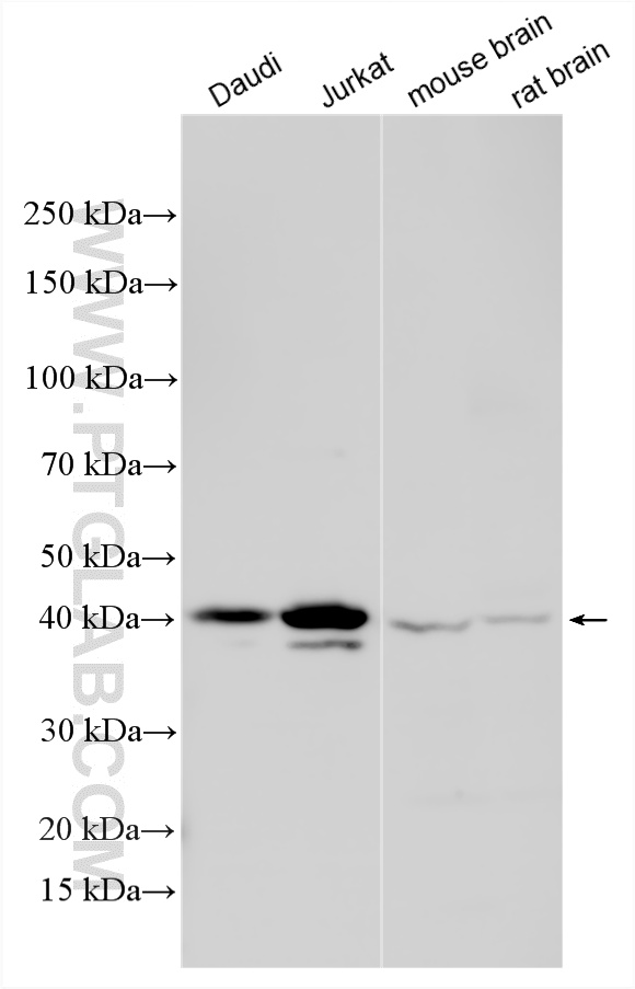 WB analysis using 13640-1-AP