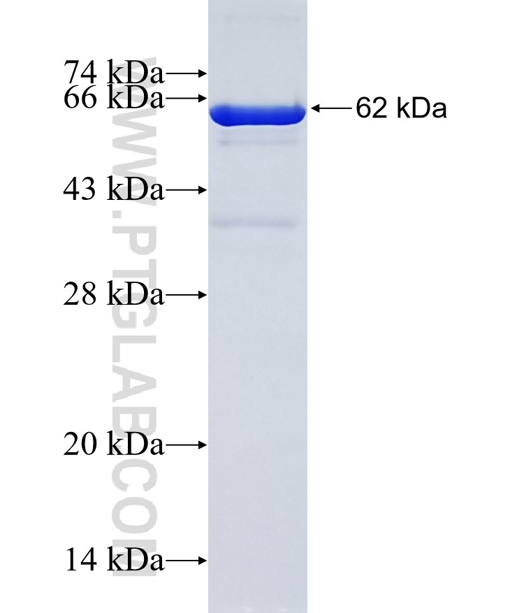 BCAT1 fusion protein Ag4574 SDS-PAGE