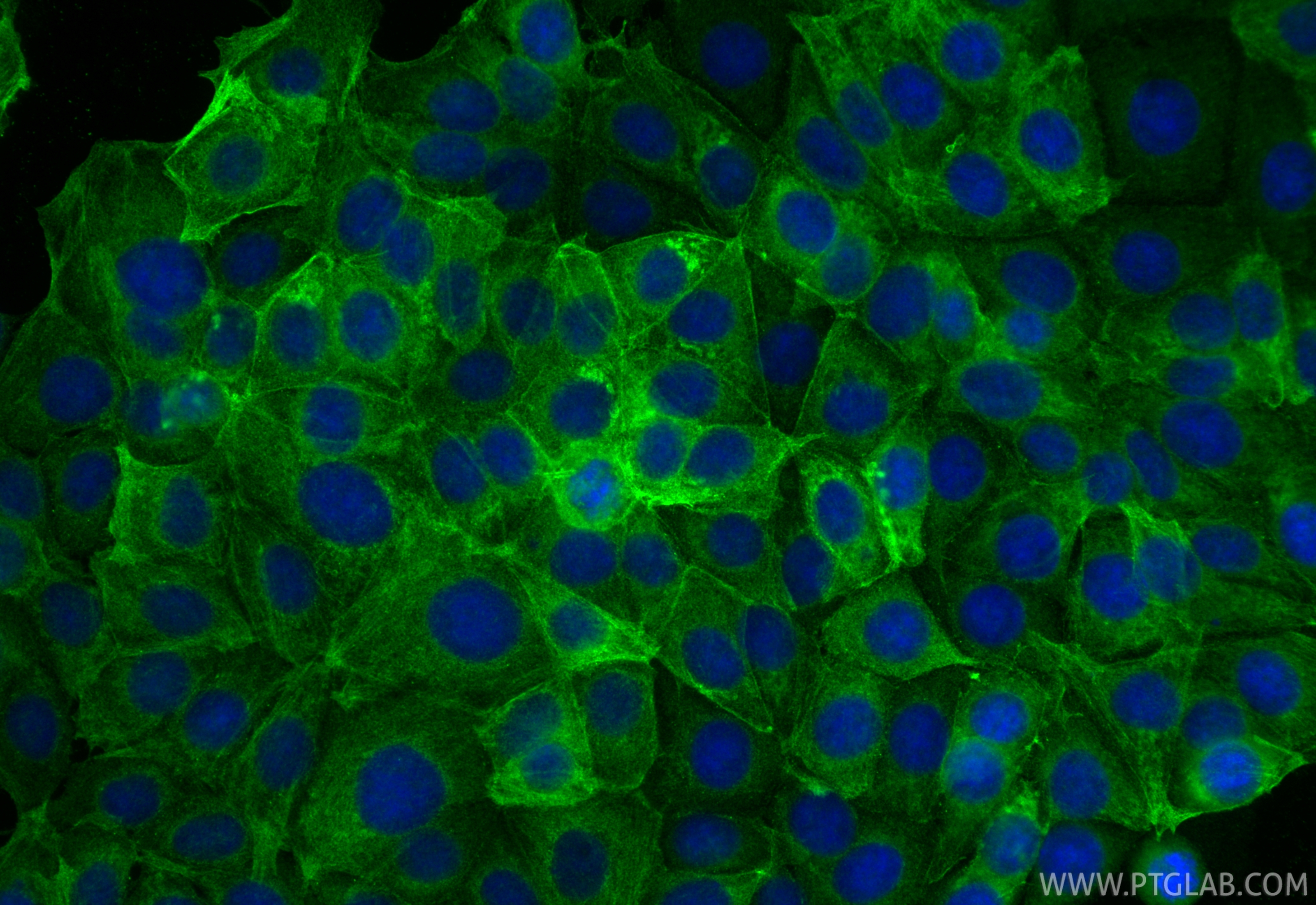 IF Staining of MCF-7 using 16417-1-AP IF Staining of MCF-7 using 16417-1-AP