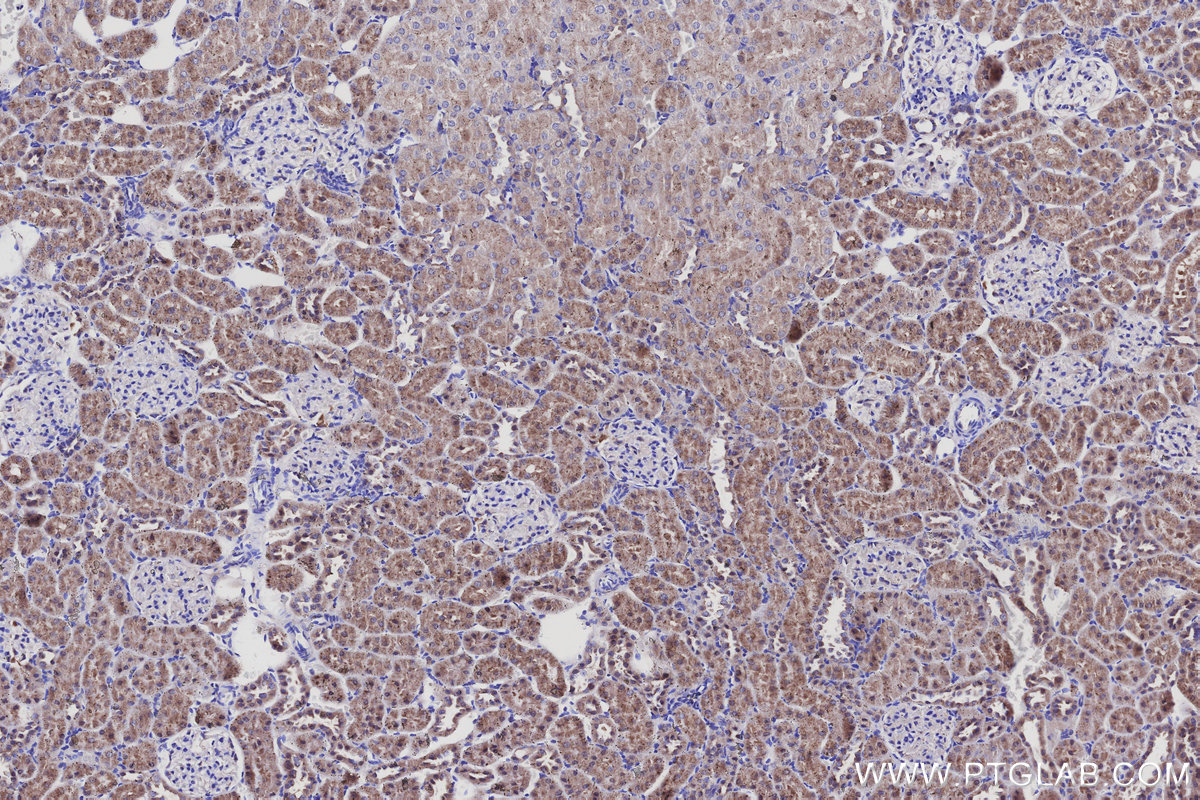 IHC staining of rat kidney using 16417-1-AP