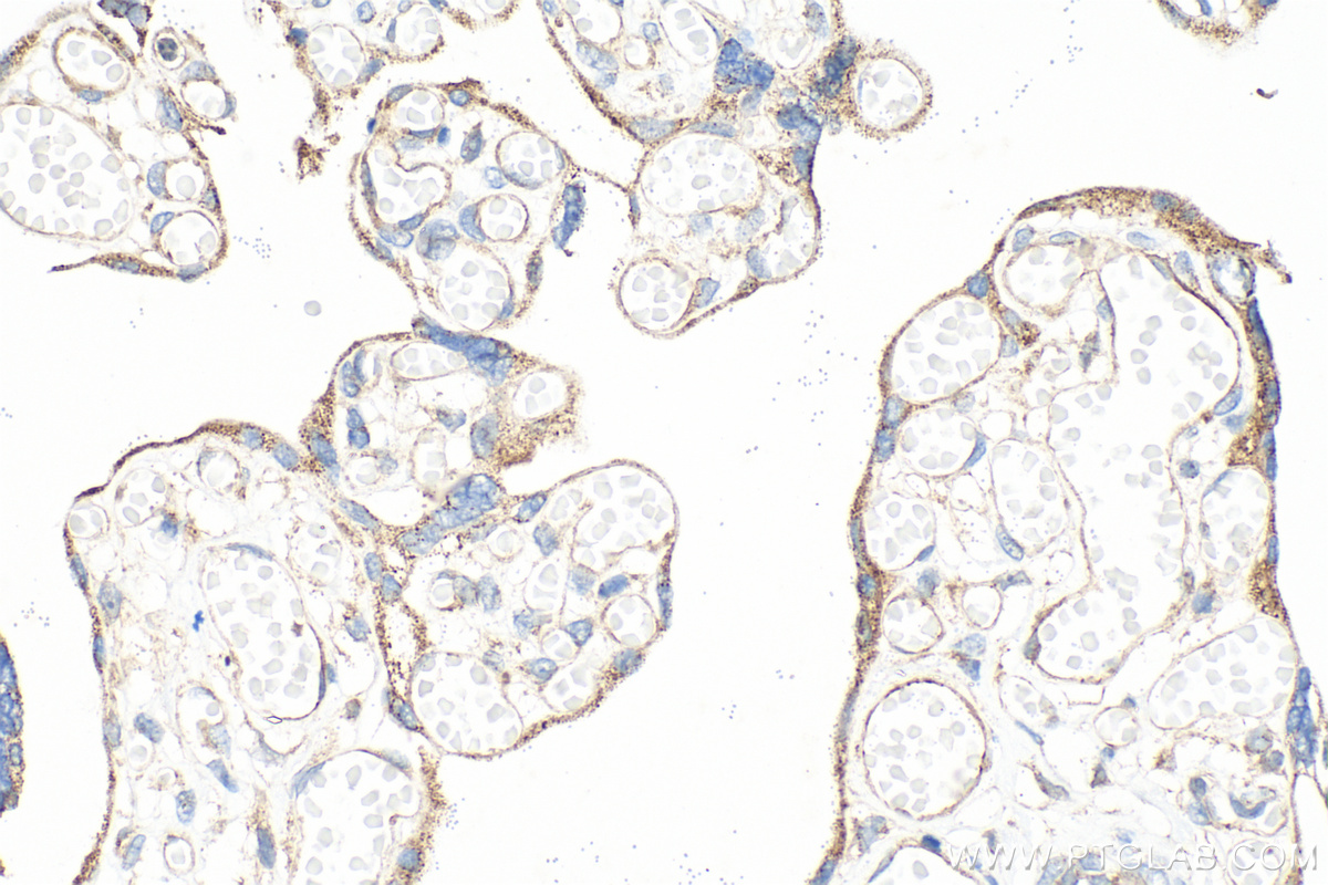 IHC staining of human placenta using 16417-1-AP