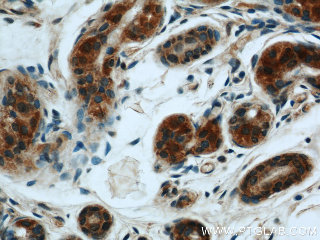 IHC staining of human skin using 16417-1-AP