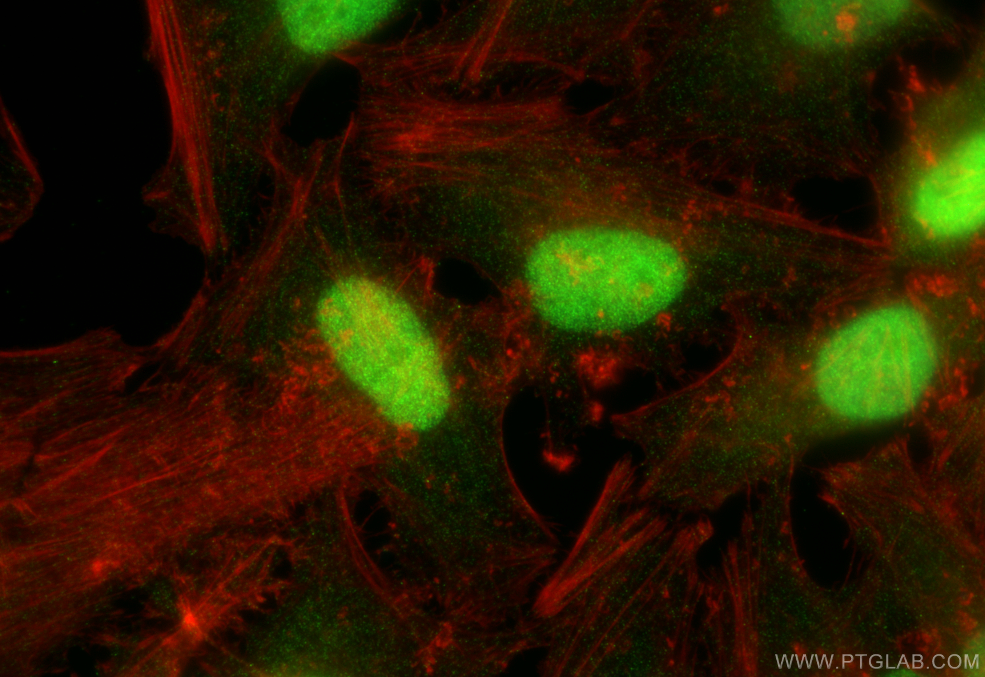 IF Staining of HeLa using 16043-1-AP