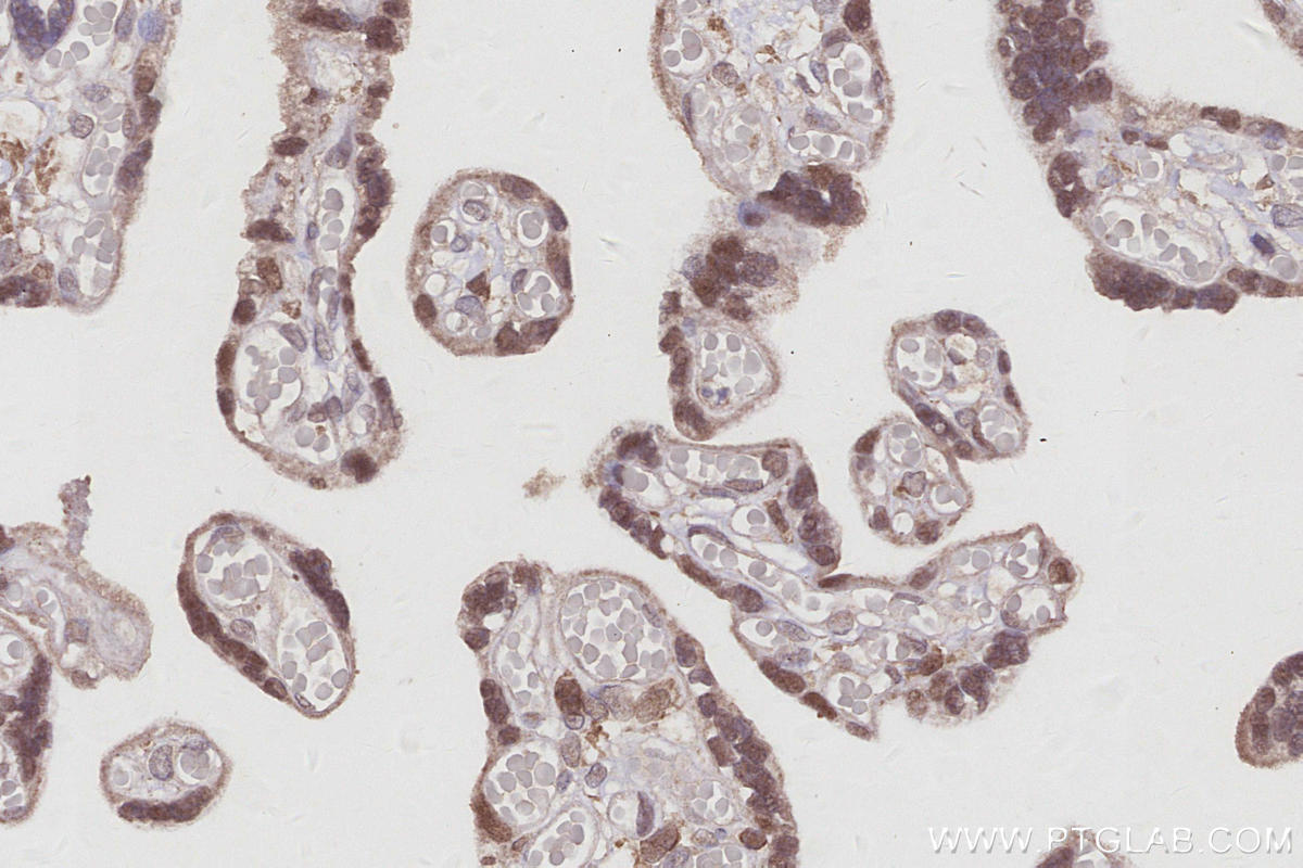 IHC staining of human placenta using 16043-1-AP IHC staining of human placenta using 16043-1-AP