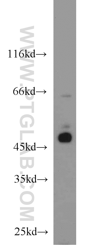 WB analysis of HeLa using 16043-1-AP