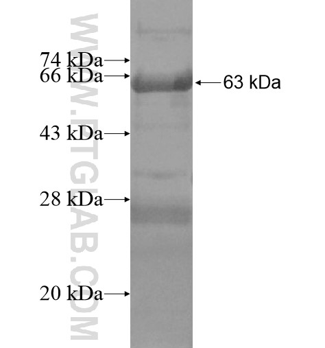 BCDIN3D fusion protein Ag15613 SDS-PAGE