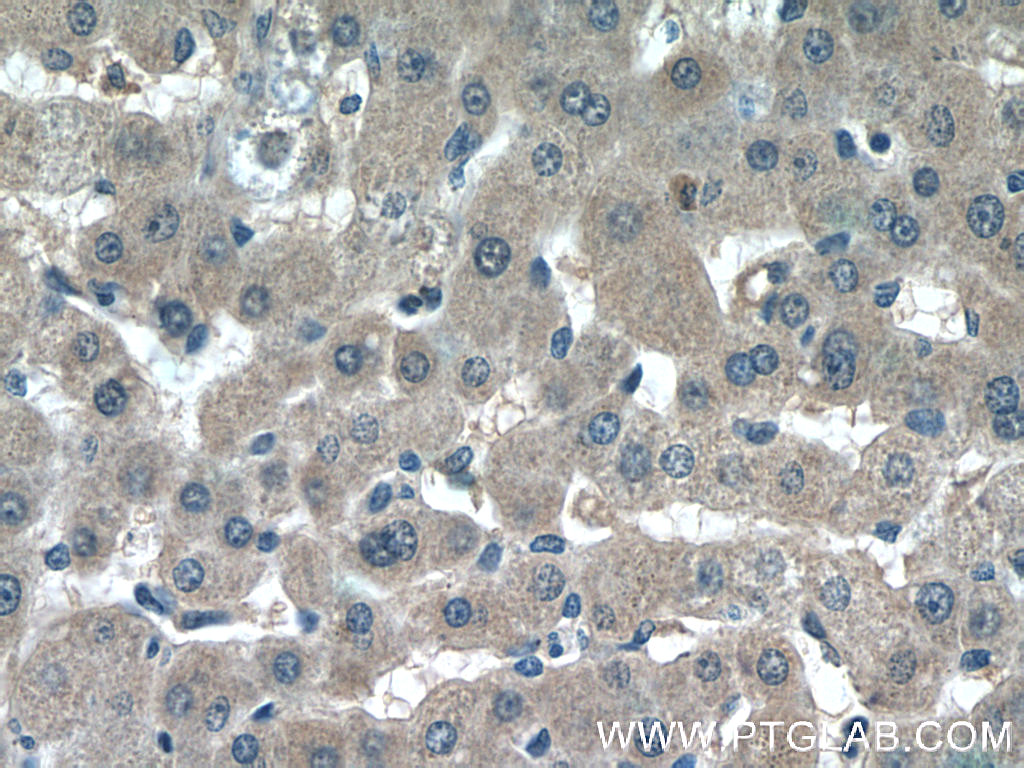 BCHE Polyclonal antibody