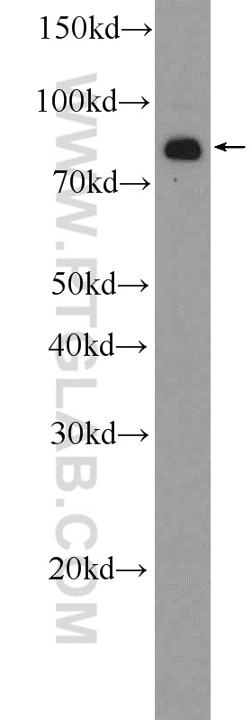 WB analysis of HeLa using 23854-1-AP