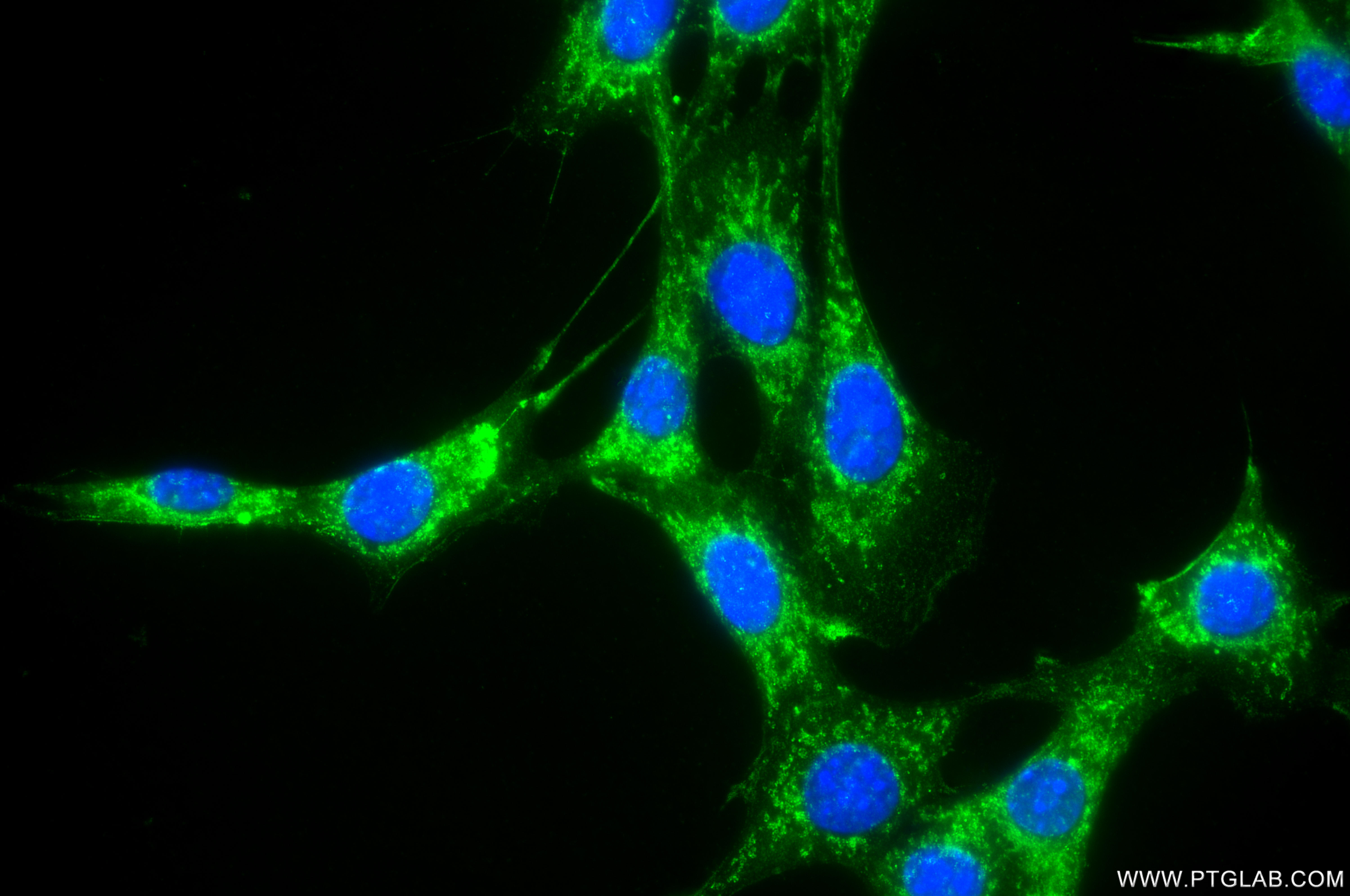 IF Staining of NIH/3T3 using 85799-3-RR