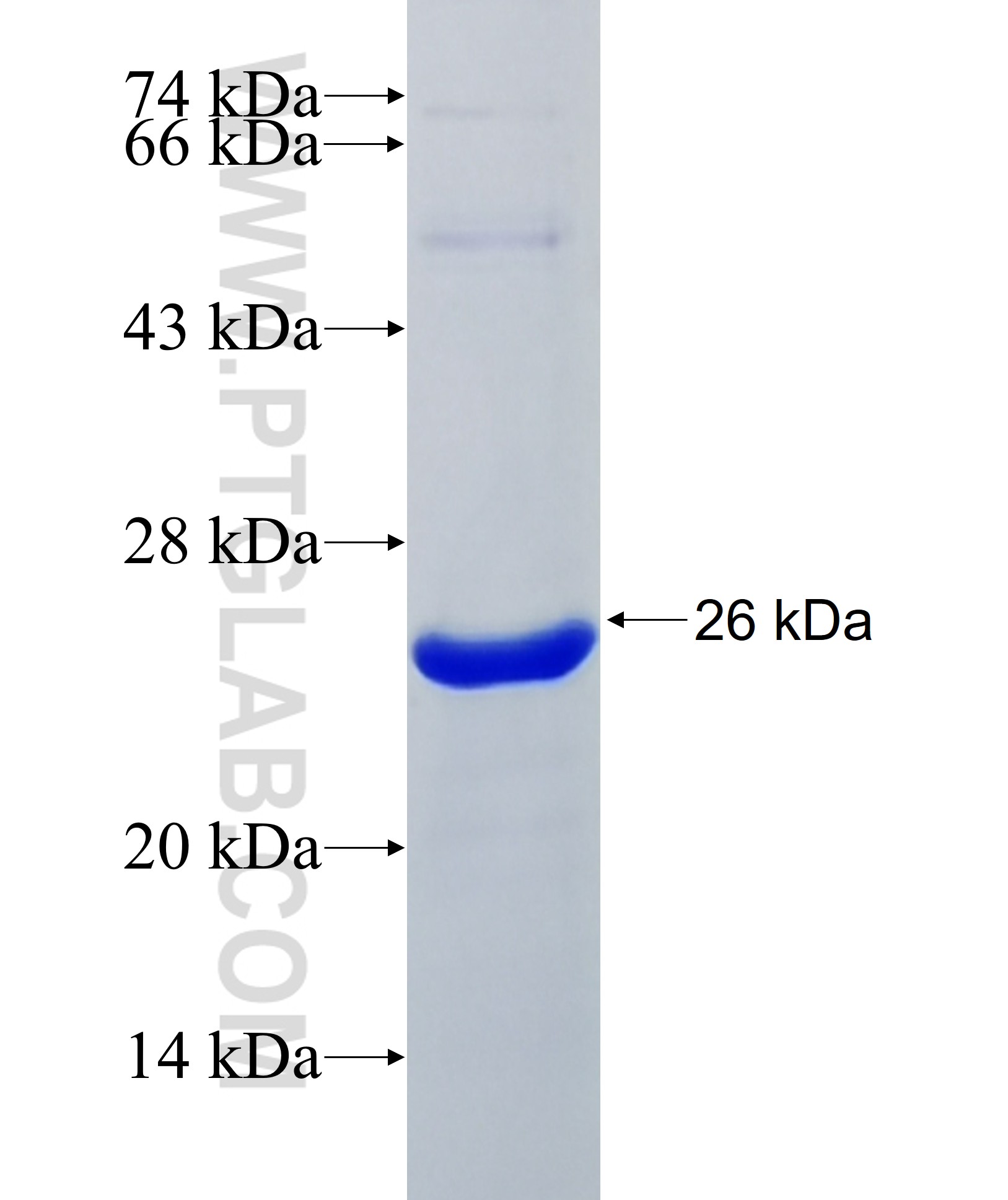 BCKDHA fusion protein Ag32633 SDS-PAGE BCKDHA fusion protein Ag32633 SDS-PAGE