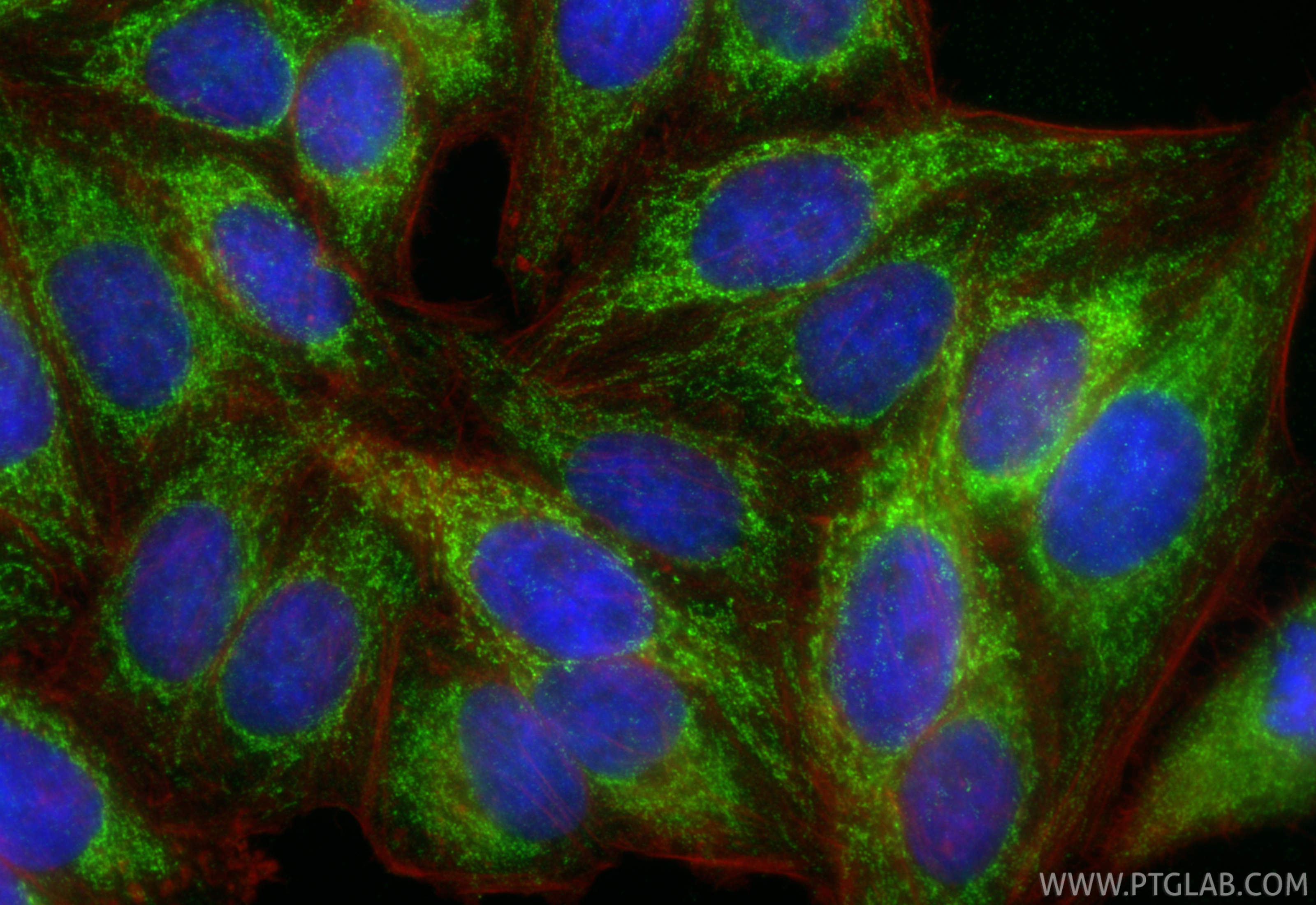 IF Staining of HepG2 using 15718-1-AP IF Staining of HepG2 using 15718-1-AP