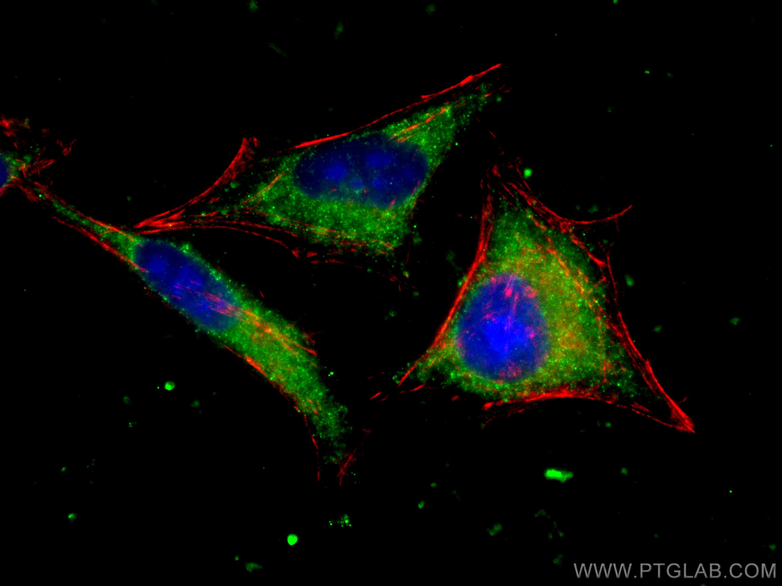 IF Staining of HepG2 using 66556-1-Ig (same clone as 66556-1-PBS)