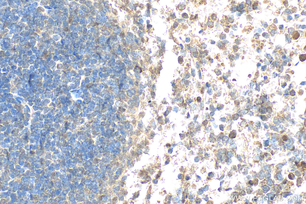 IHC staining of mouse spleen using 11613-1-AP