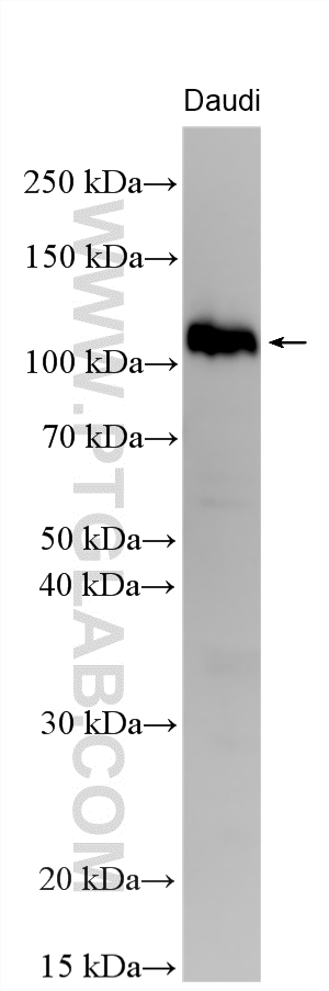 WB analysis using 11613-1-AP
