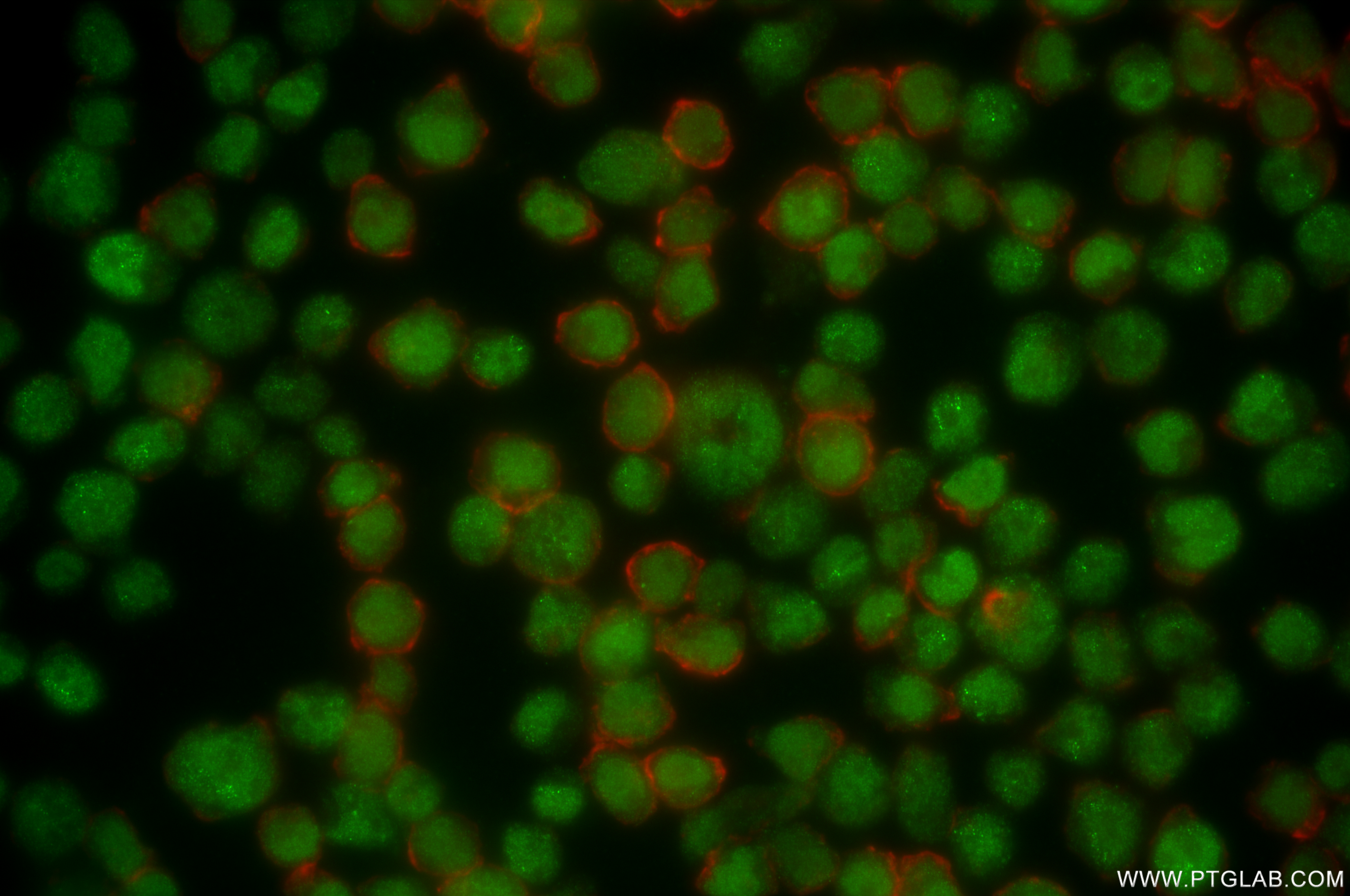 IF Staining of Jurkat using 84930-3-RR